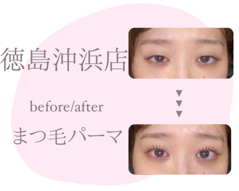 記事のサムネイル