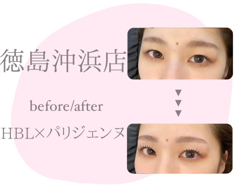 記事のサムネイル